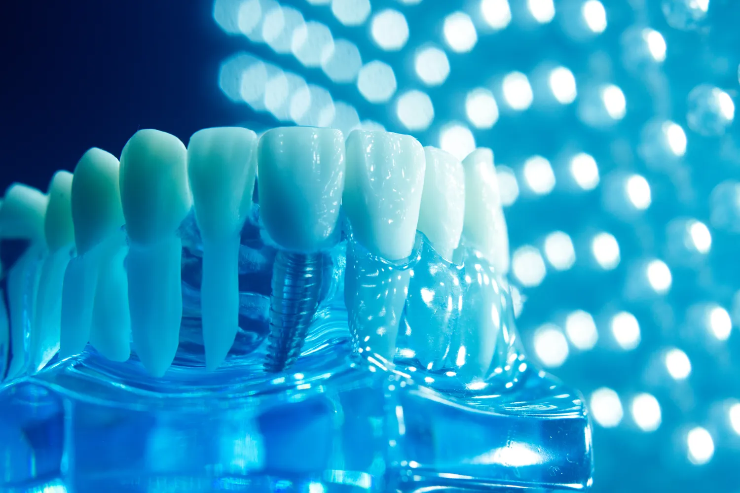 Protetyka cyfrowa Warszawa