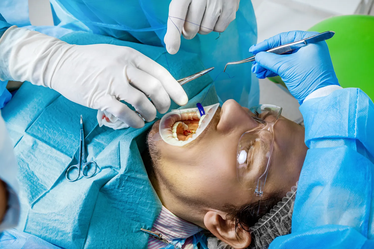 Na czym polega kanałowe leczenie zęba?