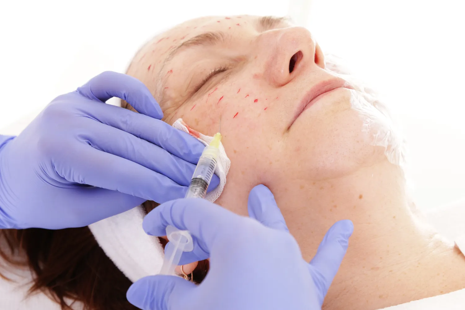 Dlaczego warto wypromować swoją klinikę medycyny estetycznej w sieci?